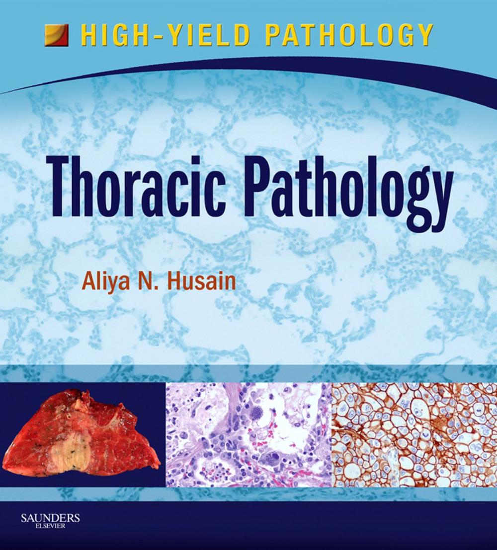 Big bigCover of Thoracic Pathology E-Book