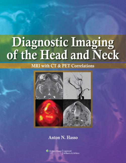 Cover of the book Diagnostic Imaging of the Head and Neck by Anton N. Hasso, Wolters Kluwer Health