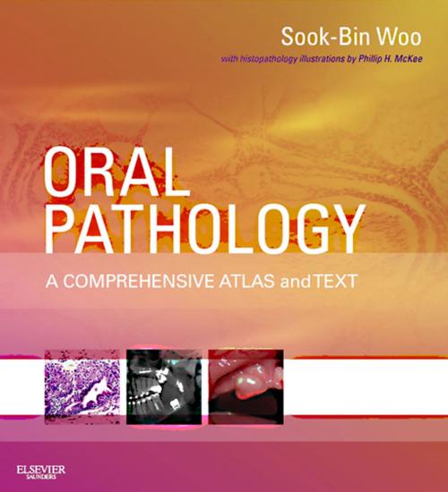 Cover of the book Oral Pathology E-Book by Sook-Bin Woo, DMD, MMSc, Elsevier Health Sciences