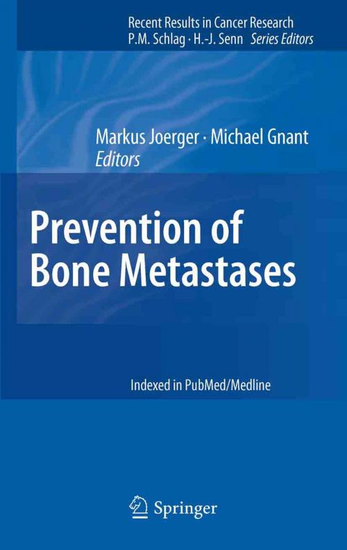 Cover of the book Prevention of Bone Metastases by , Springer Berlin Heidelberg