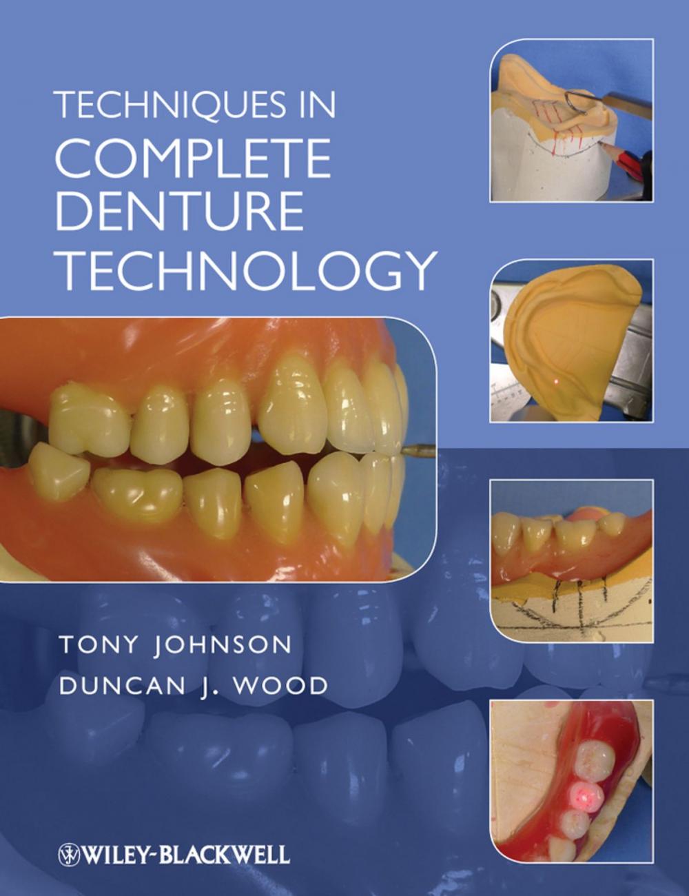 Big bigCover of Techniques in Complete Denture Technology