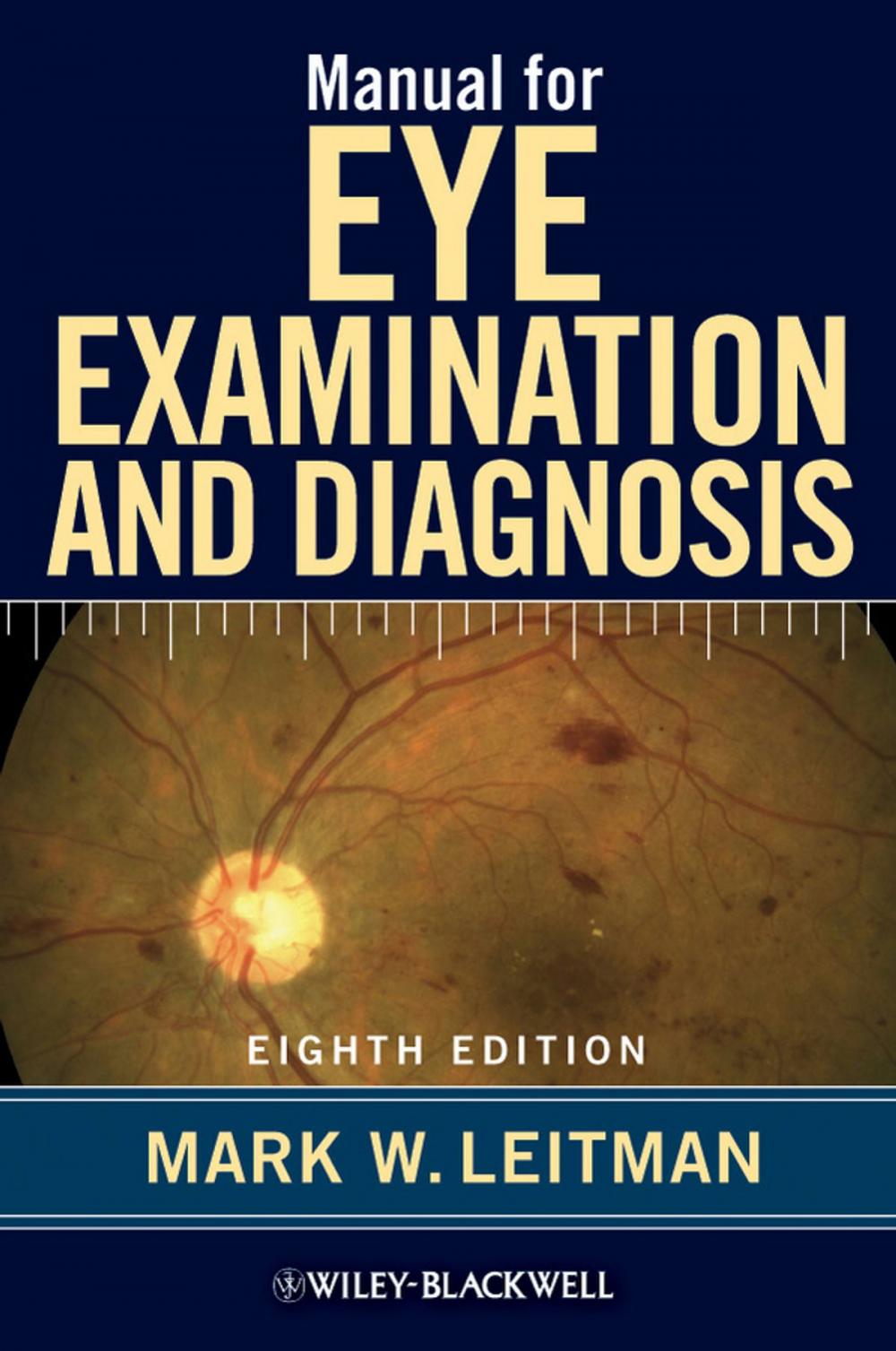 Big bigCover of Manual for Eye Examination and Diagnosis