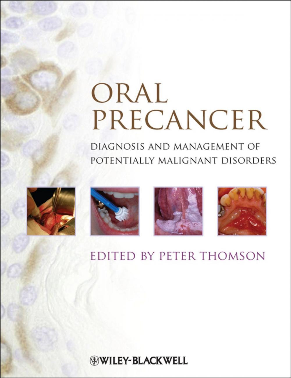 Big bigCover of Oral Precancer