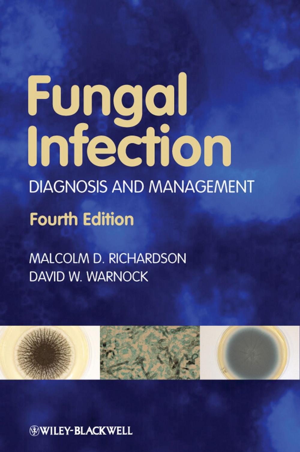 Big bigCover of Fungal Infection