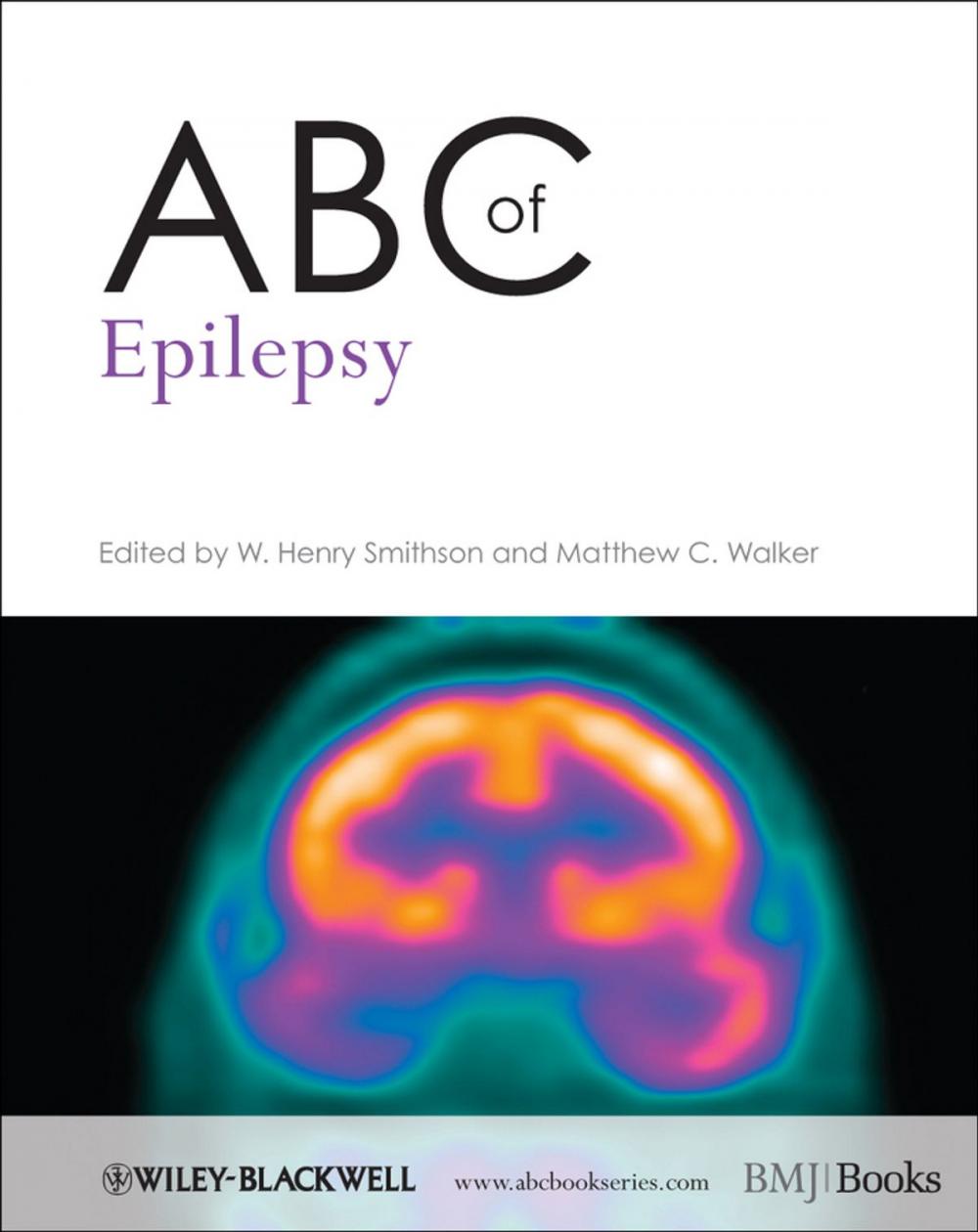 Big bigCover of ABC of Epilepsy