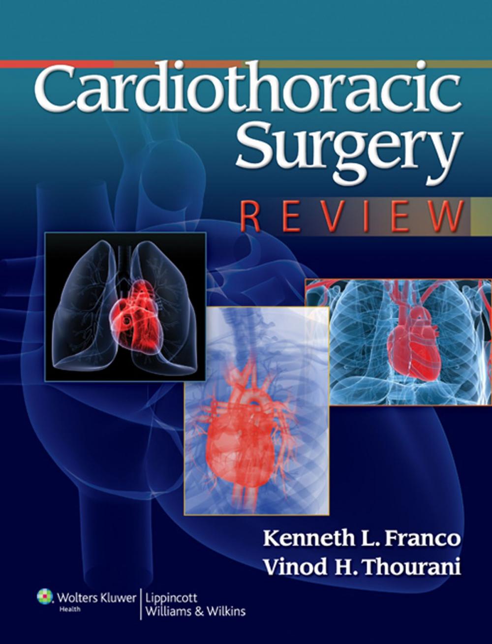 Big bigCover of Cardiothoracic Surgery Review