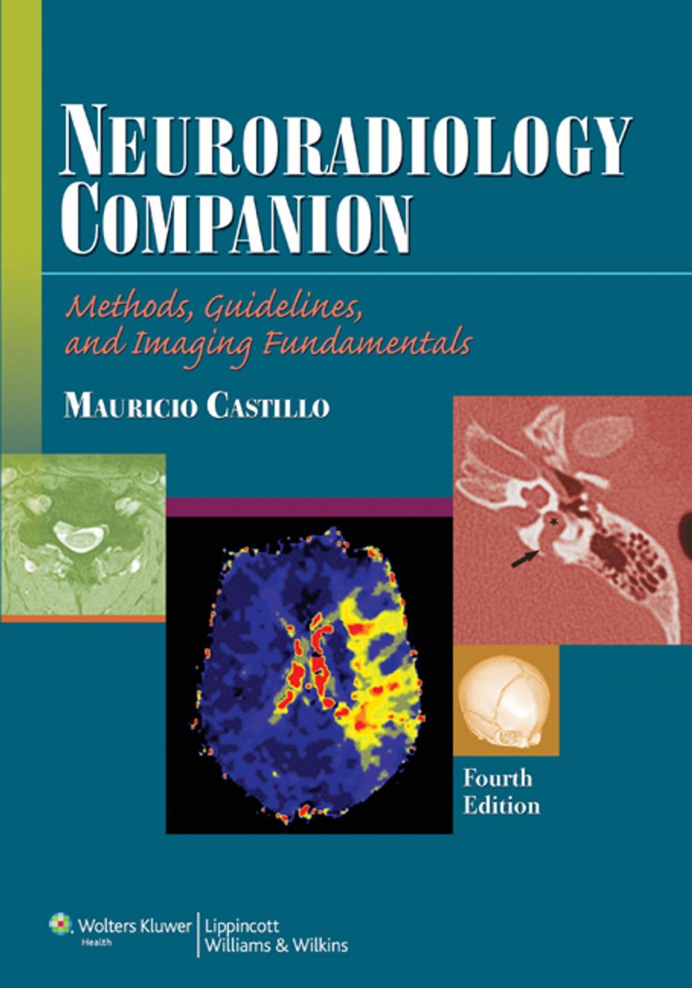 Big bigCover of Neuroradiology Companion