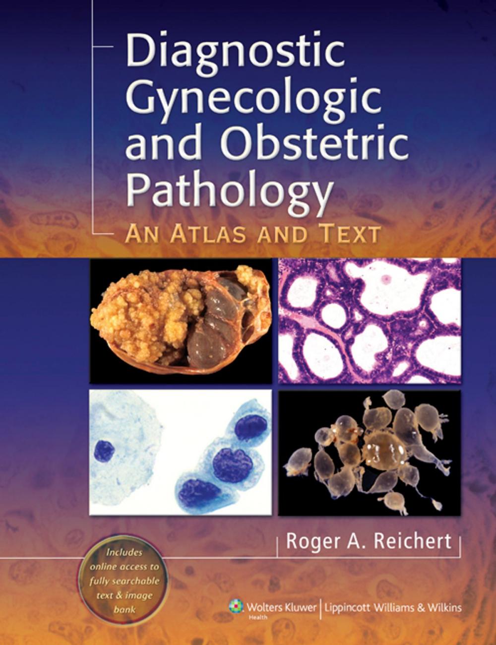 Big bigCover of Diagnostic Gynecologic and Obstetric Pathology