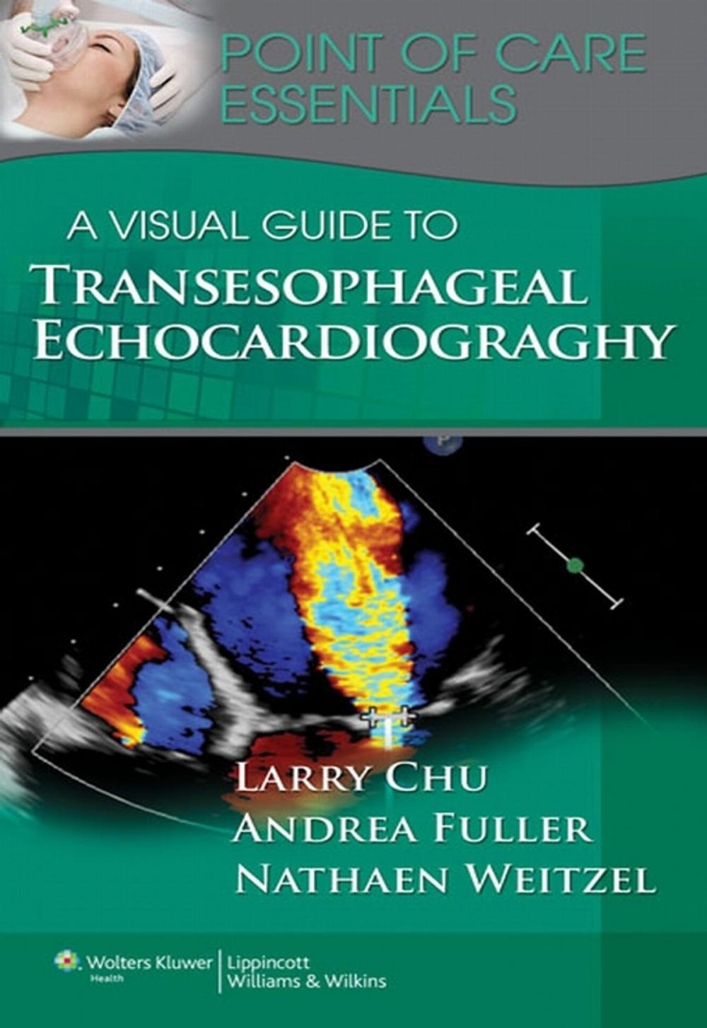 Big bigCover of A Visual Guide to Transesophageal Echocardiography