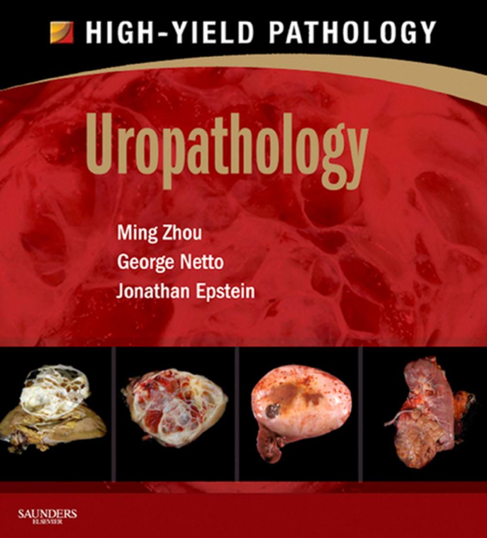 Big bigCover of Uropathology E-Book