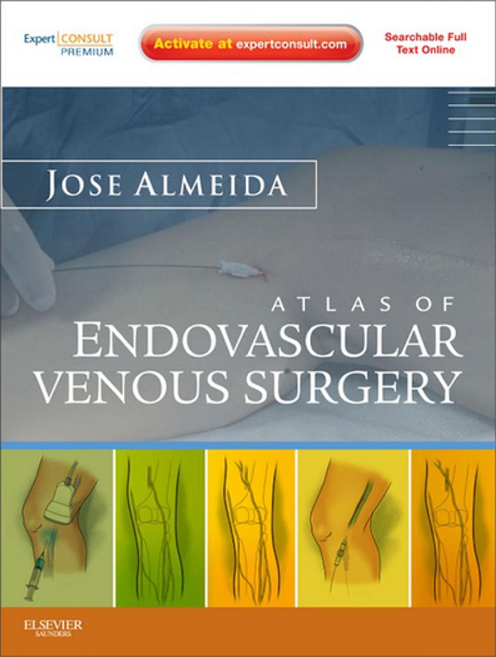 Big bigCover of Atlas of Endovascular Venous Surgery E-Book