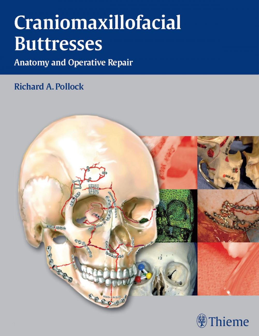 Big bigCover of Craniomaxillofacial Buttresses