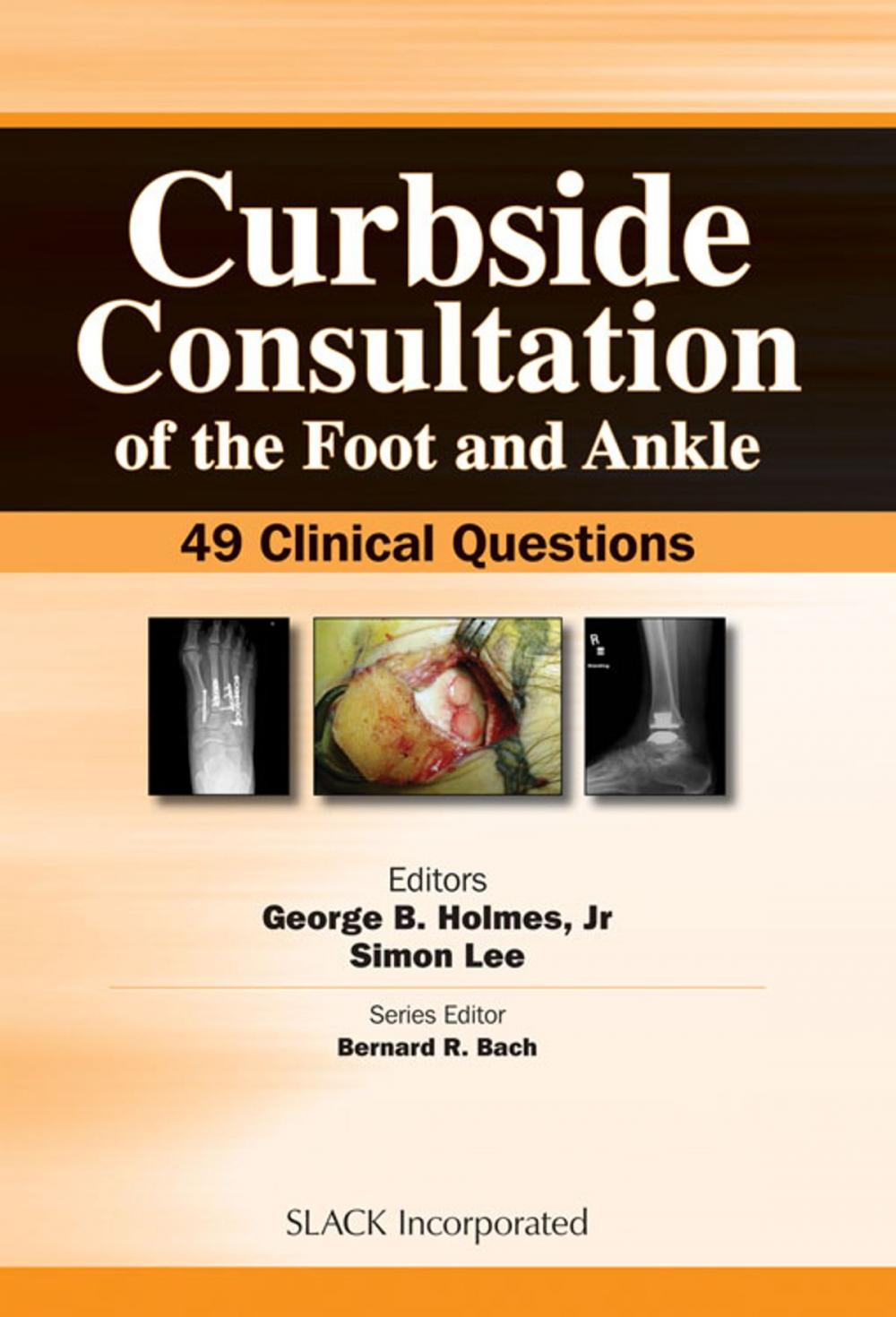 Big bigCover of Curbside Consultation of the Foot and Ankle