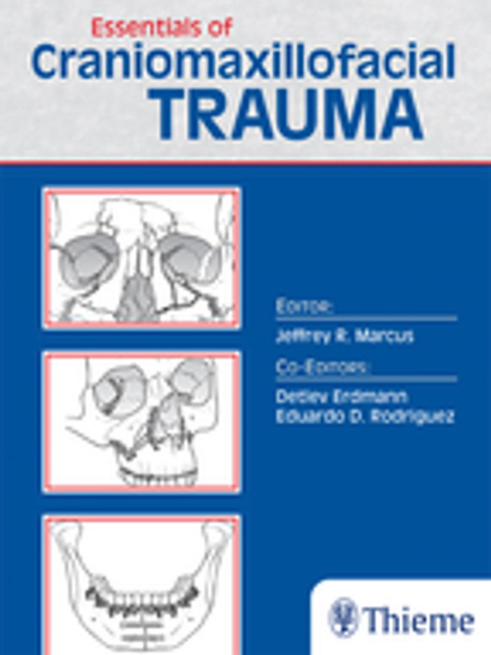 Big bigCover of Essentials of Craniomaxillofacial Trauma