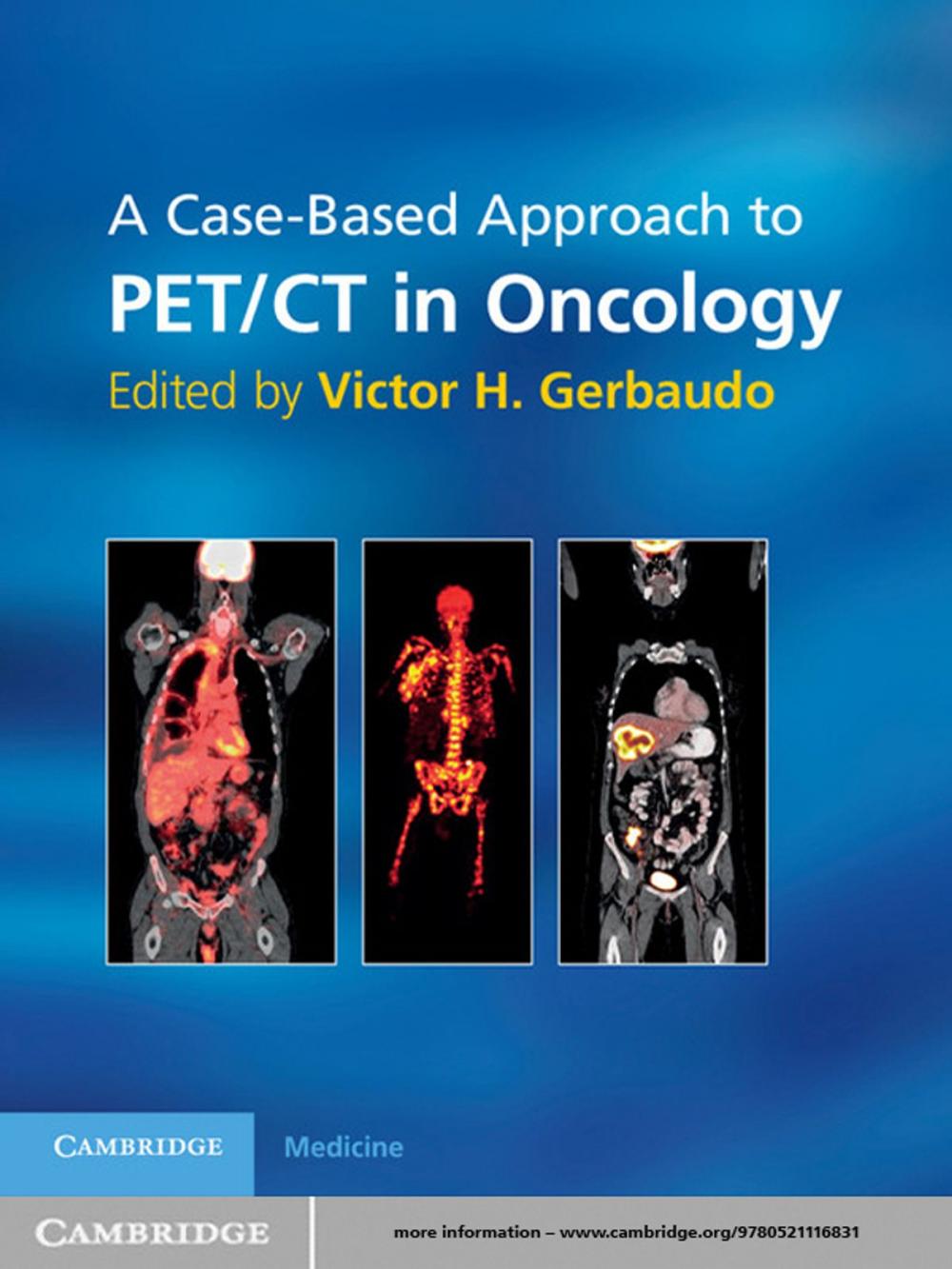 Big bigCover of A Case-Based Approach to PET/CT in Oncology