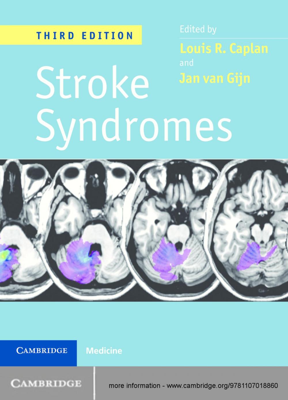 Big bigCover of Stroke Syndromes, 3ed