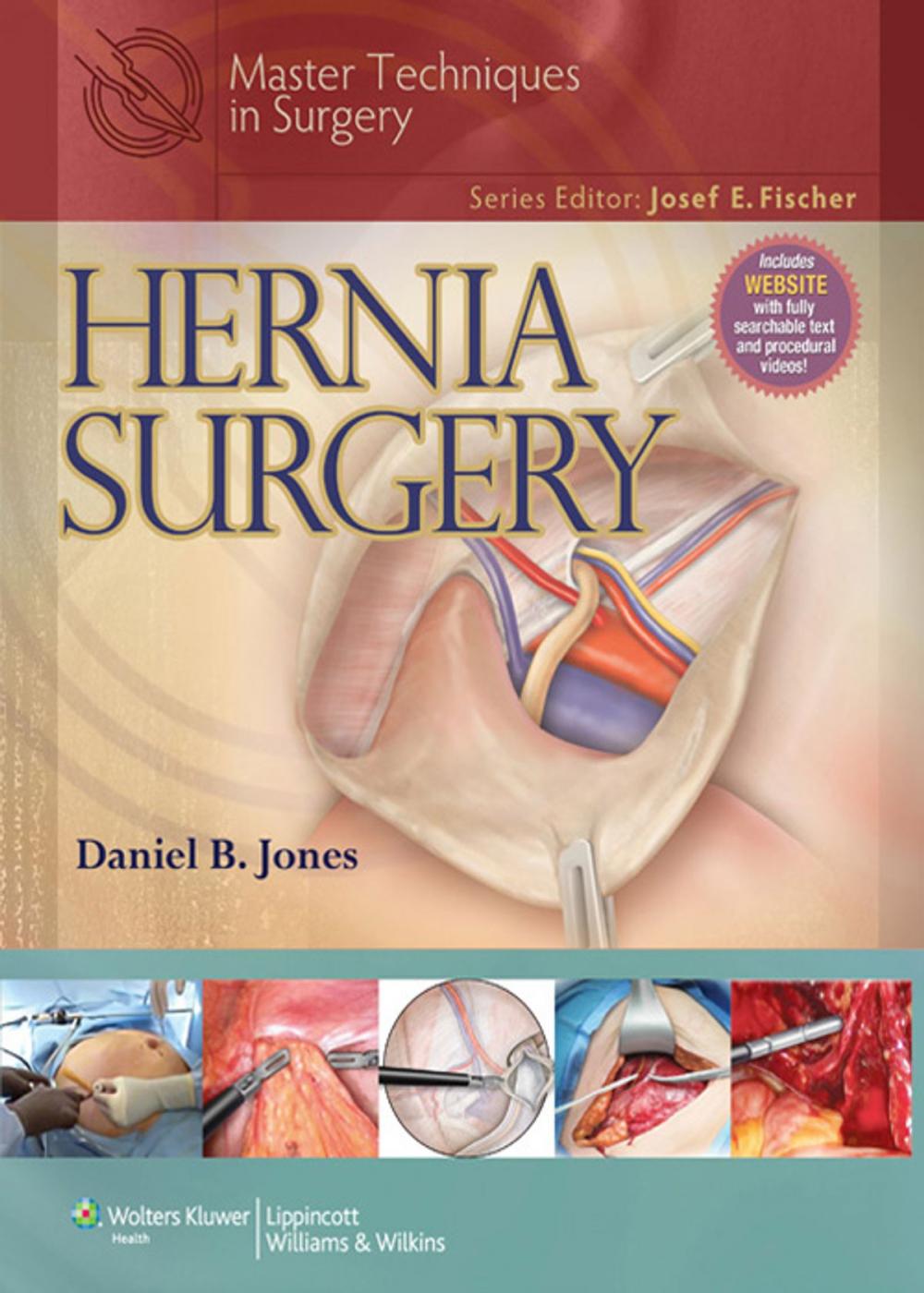 Big bigCover of Master Techniques in Surgery: Hernia