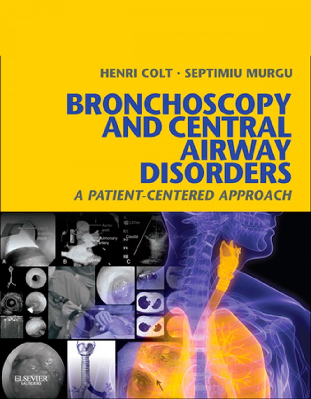 Big bigCover of Bronchoscopy and Central Airway Disorders E-Book