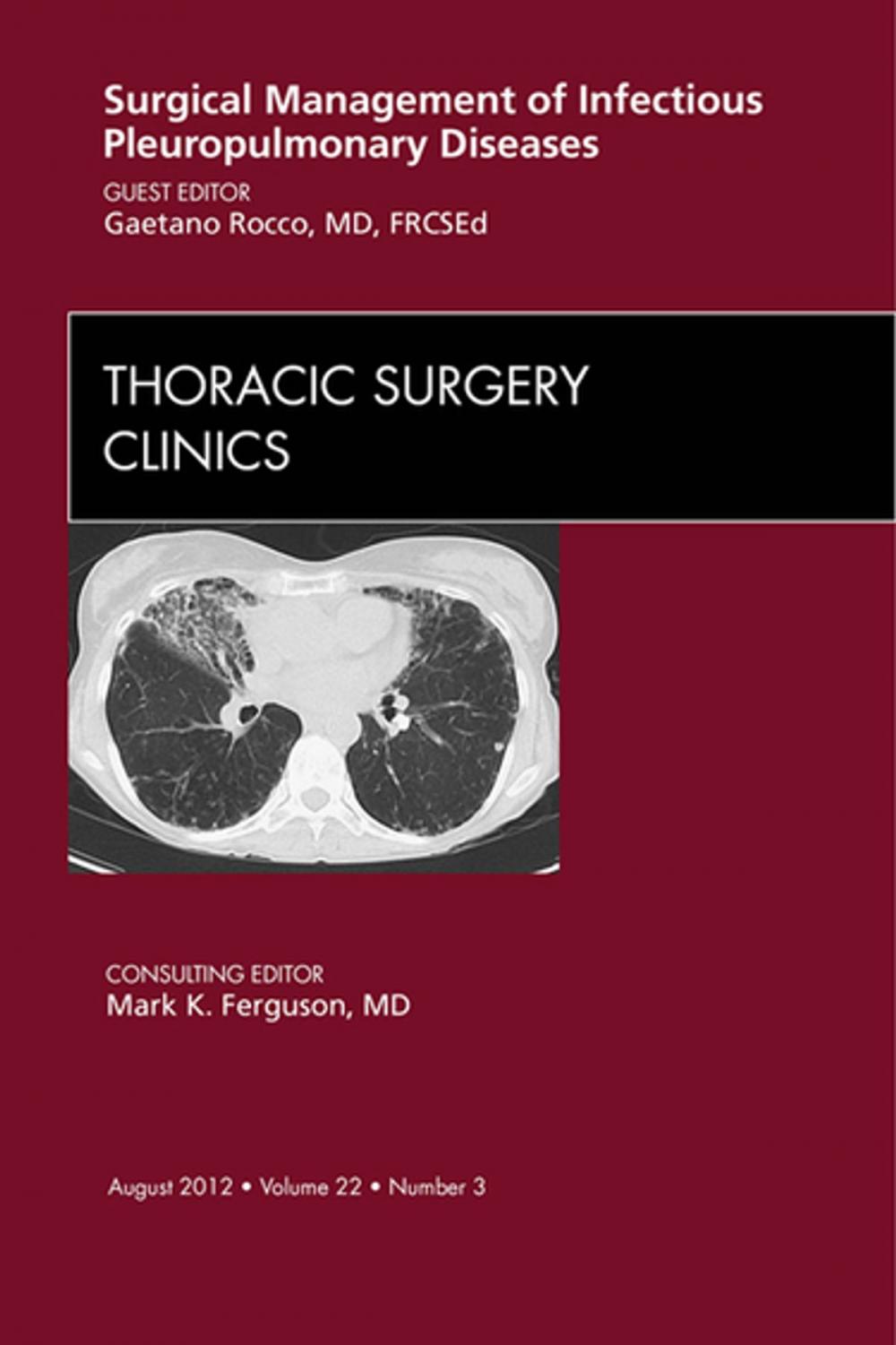 Big bigCover of Surgical Management of Infectious Pleuropulmonary Diseases, An Issue of Thoracic Surgery Clinics - E-Book