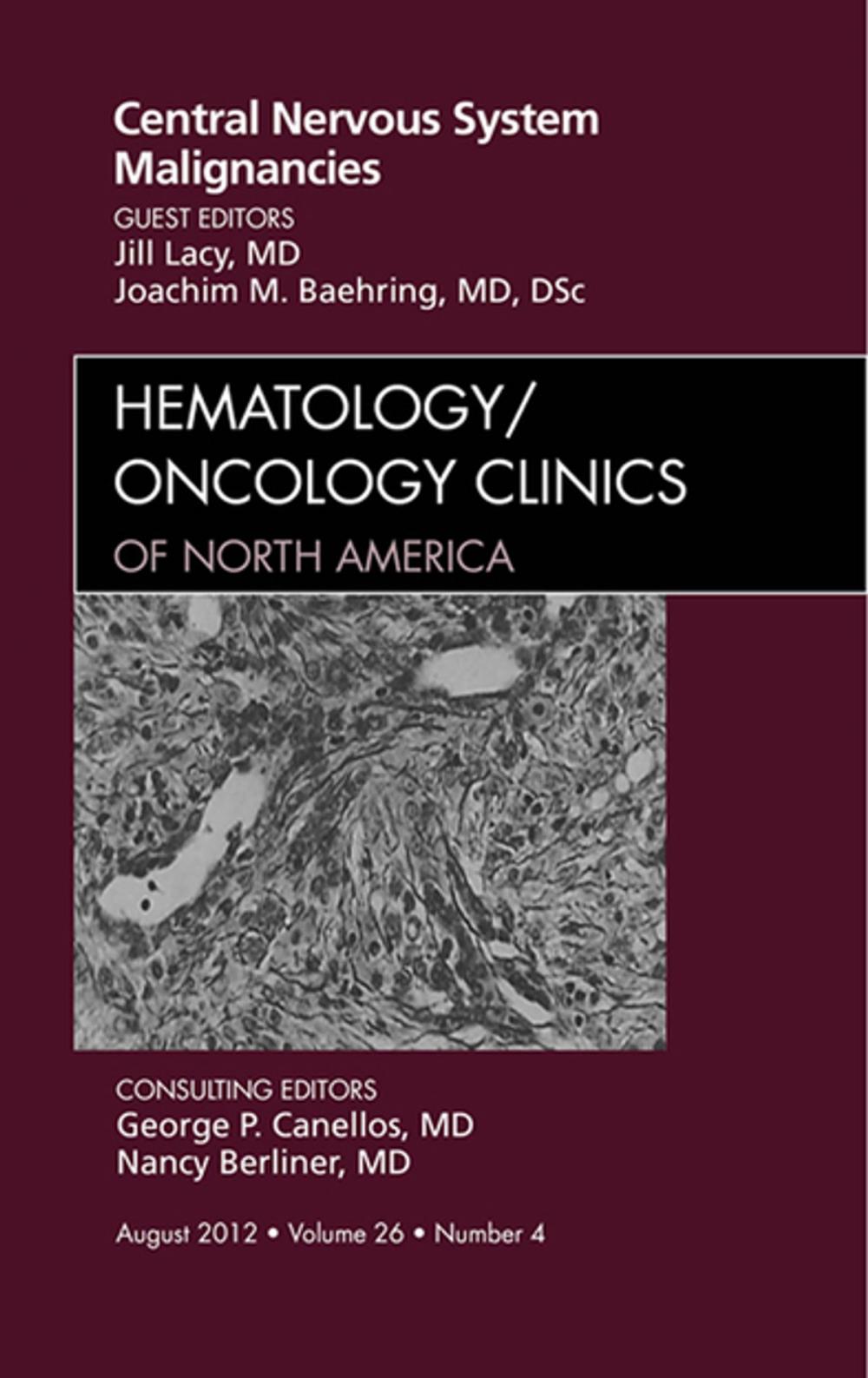 Big bigCover of Central Nervous System Malignancies, An Issue of Hematology/Oncology Clinics of North America - E-Book