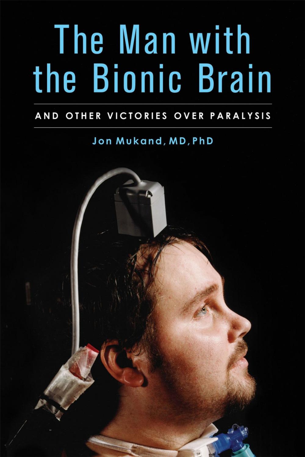 Big bigCover of The Man with the Bionic Brain