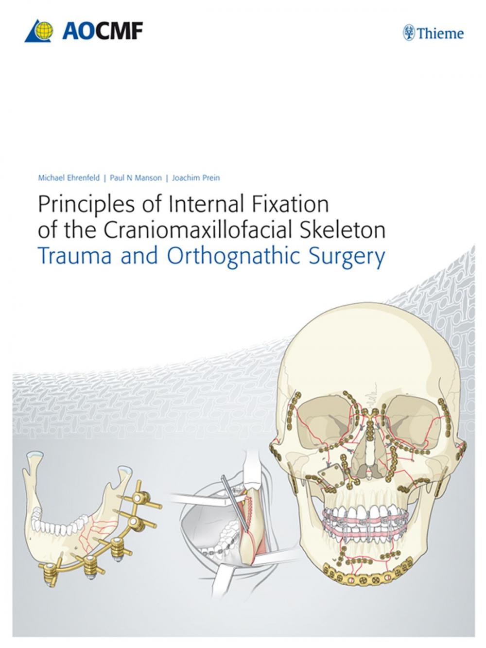 Big bigCover of Principles of Internal Fixation of the Craniomaxillofacial Skeleton