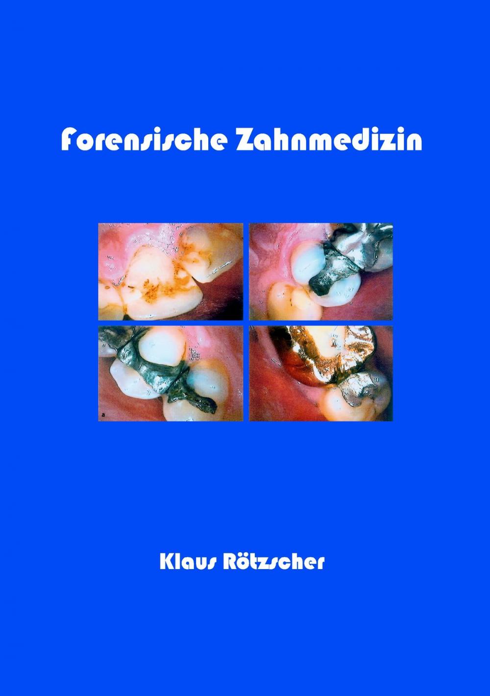 Big bigCover of Forensische Zahnmedizin