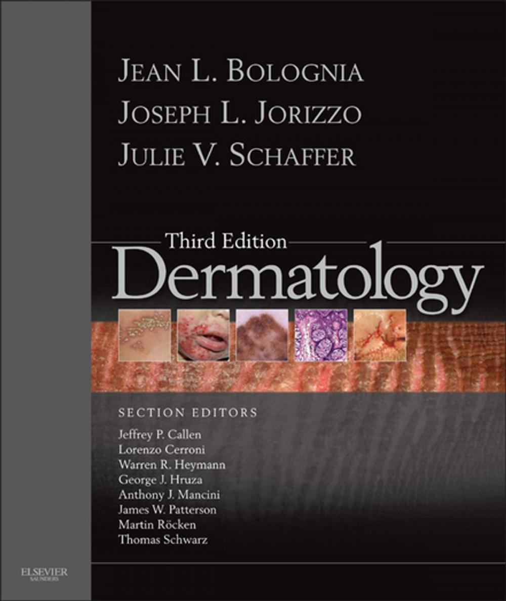 Big bigCover of Dermatology E-Book