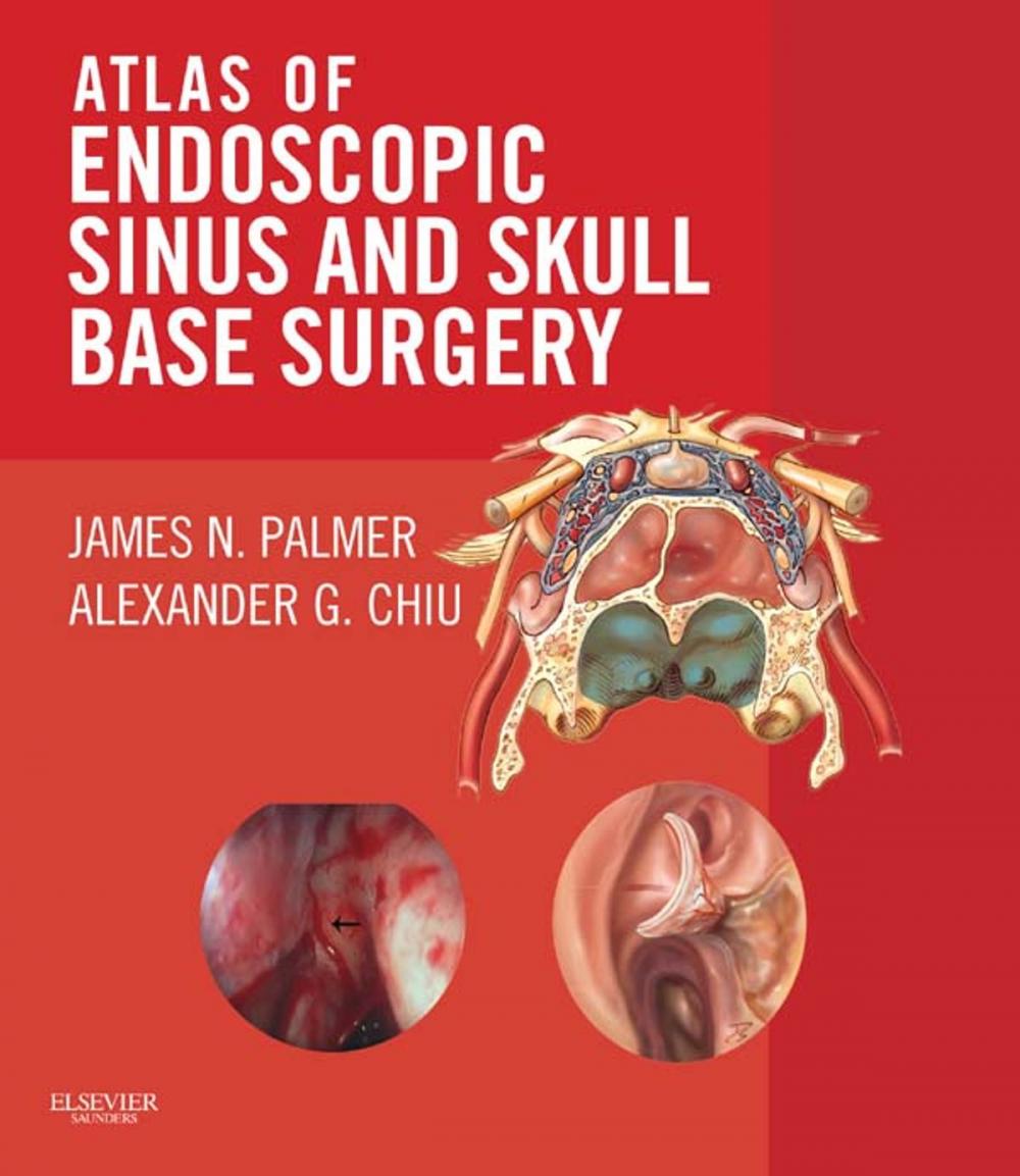 Big bigCover of Atlas of Endoscopic Sinus and Skull Base Surgery E-Book