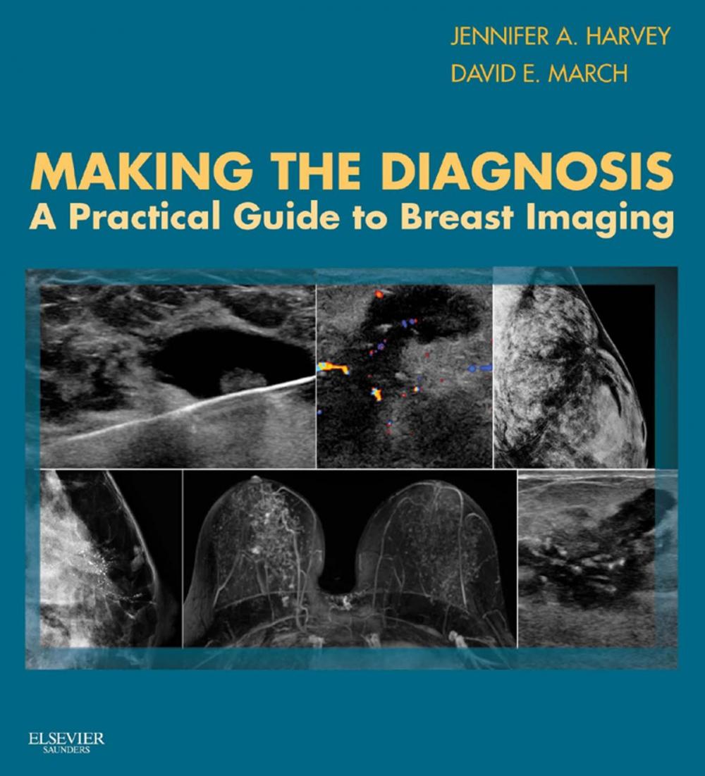 Big bigCover of Making the Diagnosis: A Practical Guide to Breast Imaging E-Book