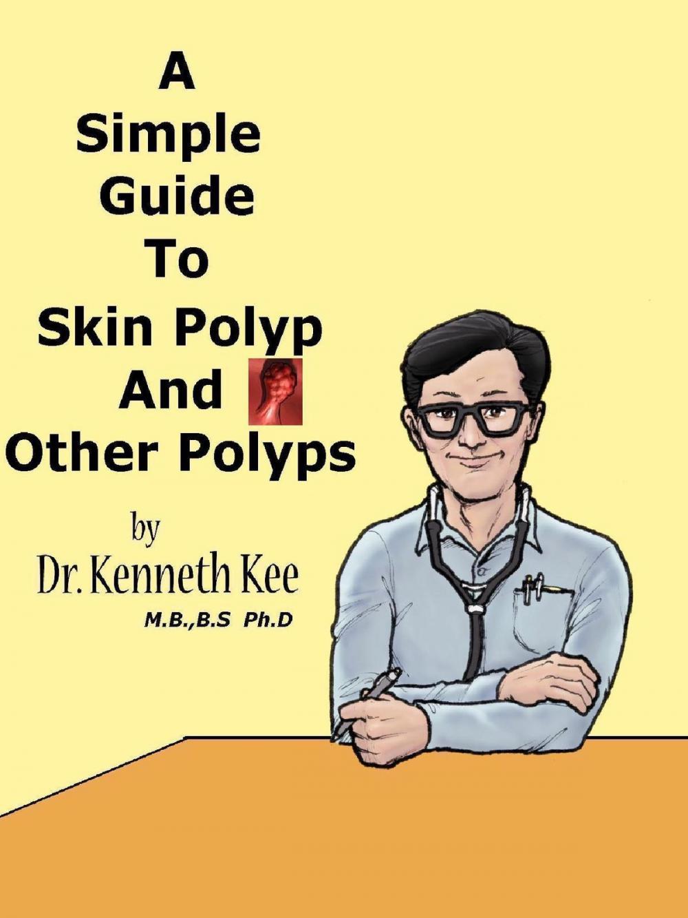 Big bigCover of A Simple Guide to Skin Polyp and Other Polyps