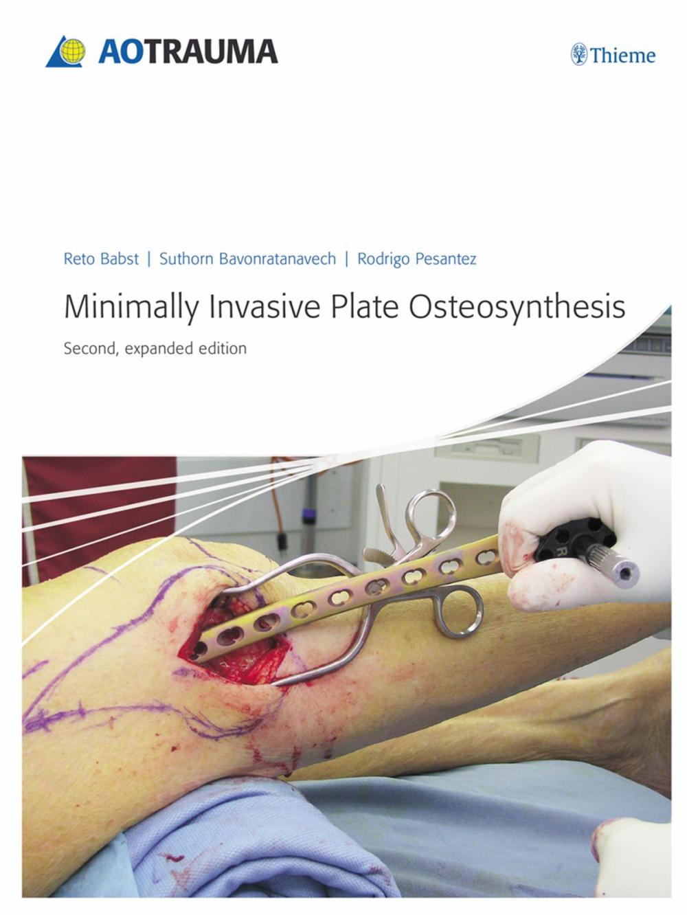 Big bigCover of Minimally Invasive Plate Osteosynthesis (MIPO)