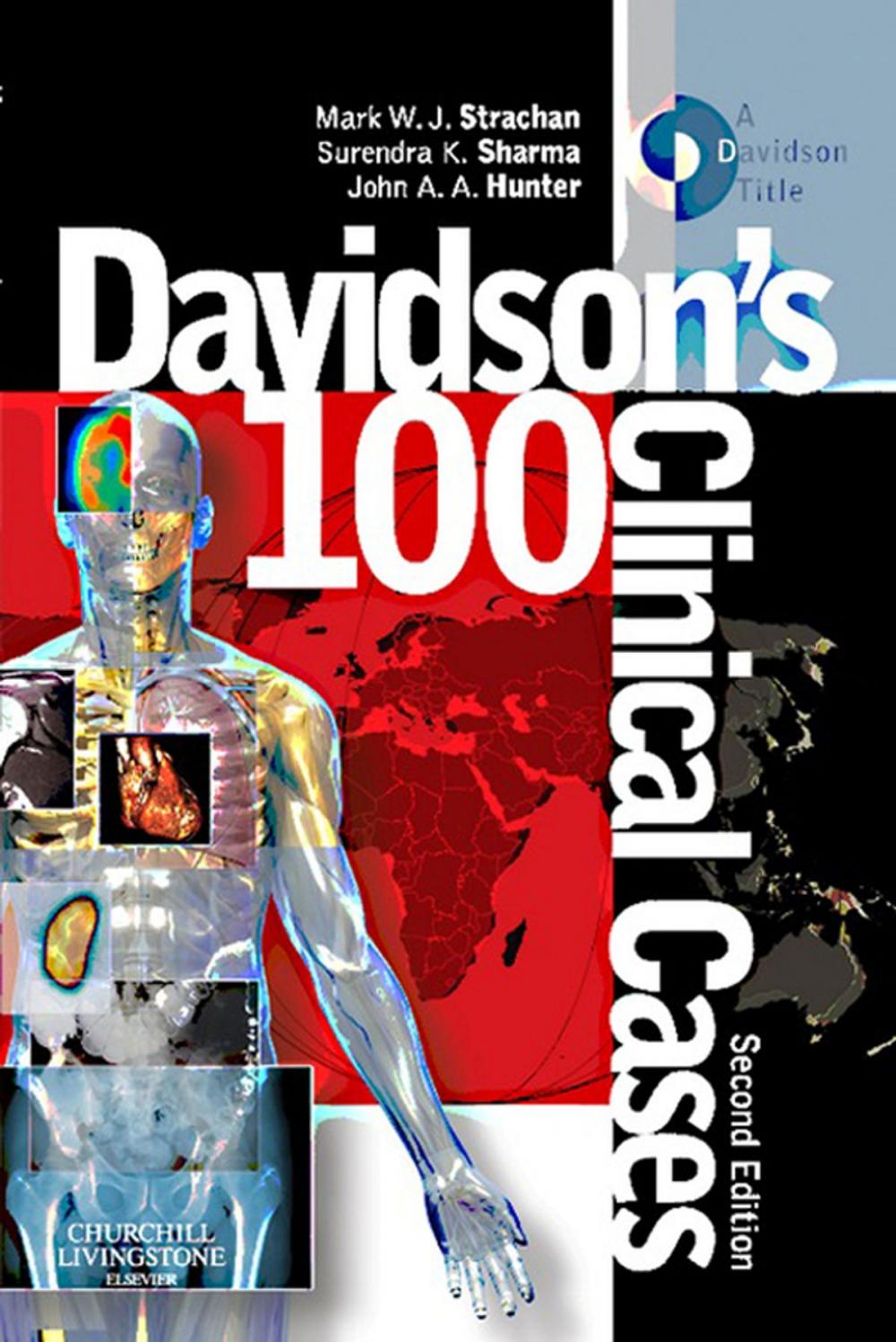 Big bigCover of Davidson's 100 Clinical Cases