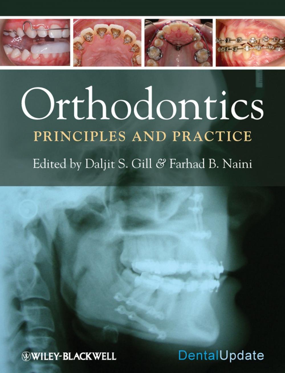 Big bigCover of Orthodontics