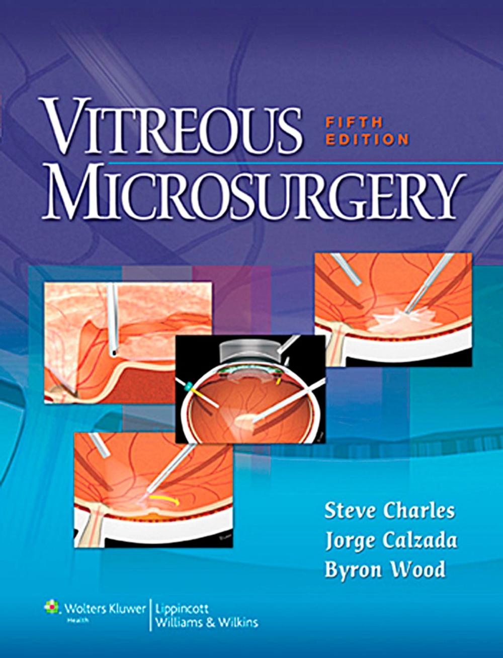 Big bigCover of Vitreous Microsurgery