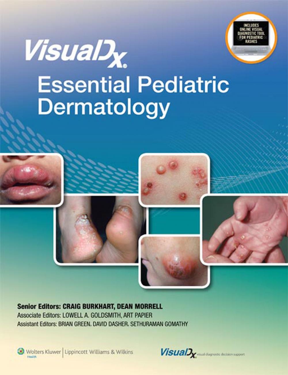 Big bigCover of VisualDx: Essential Pediatric Dermatology