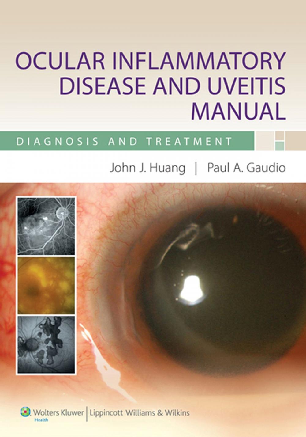 Big bigCover of Ocular Inflammatory Disease and Uveitis Manual