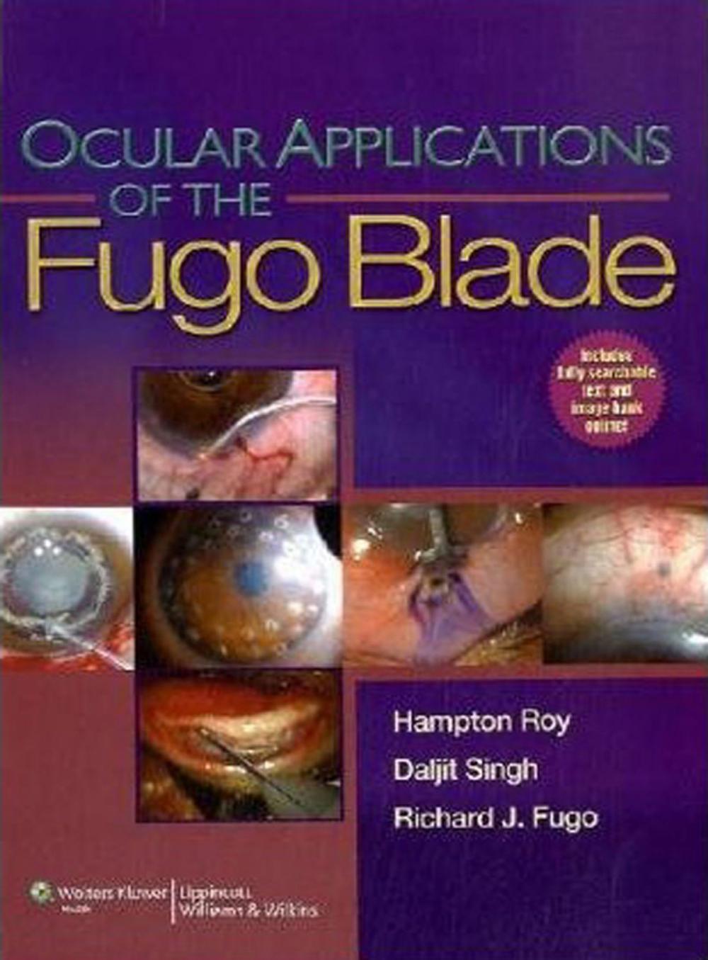 Big bigCover of Ocular Applications of the Fugo Blade