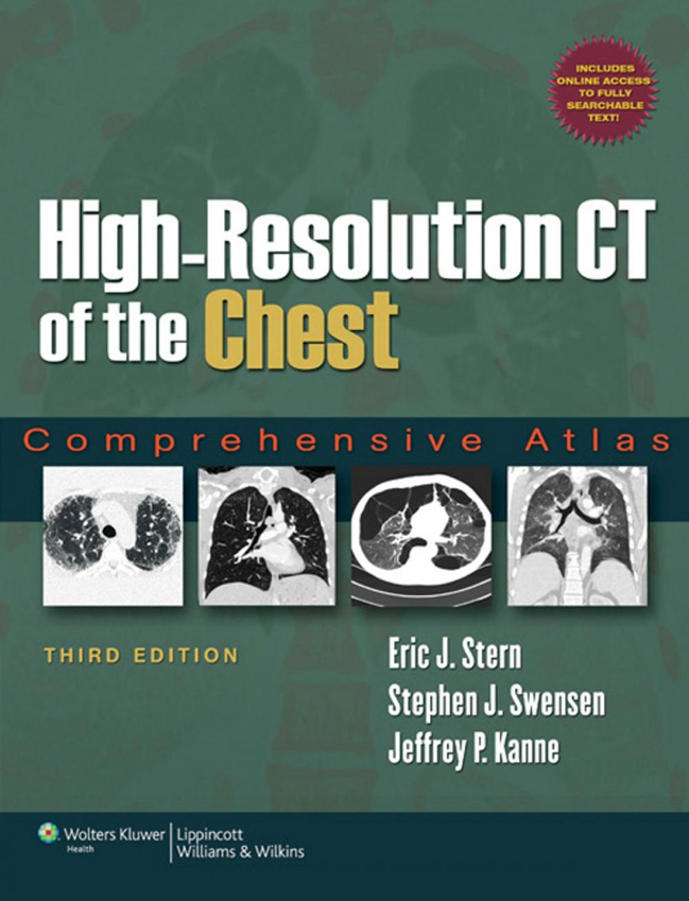 Big bigCover of High-Resolution CT of the Chest