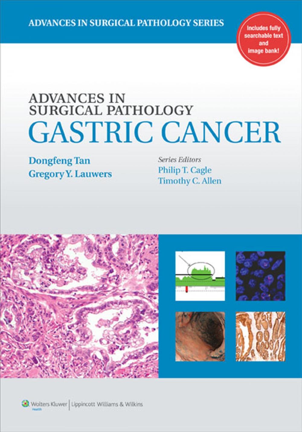 Big bigCover of Advances in Surgical Pathology: Gastric Cancer