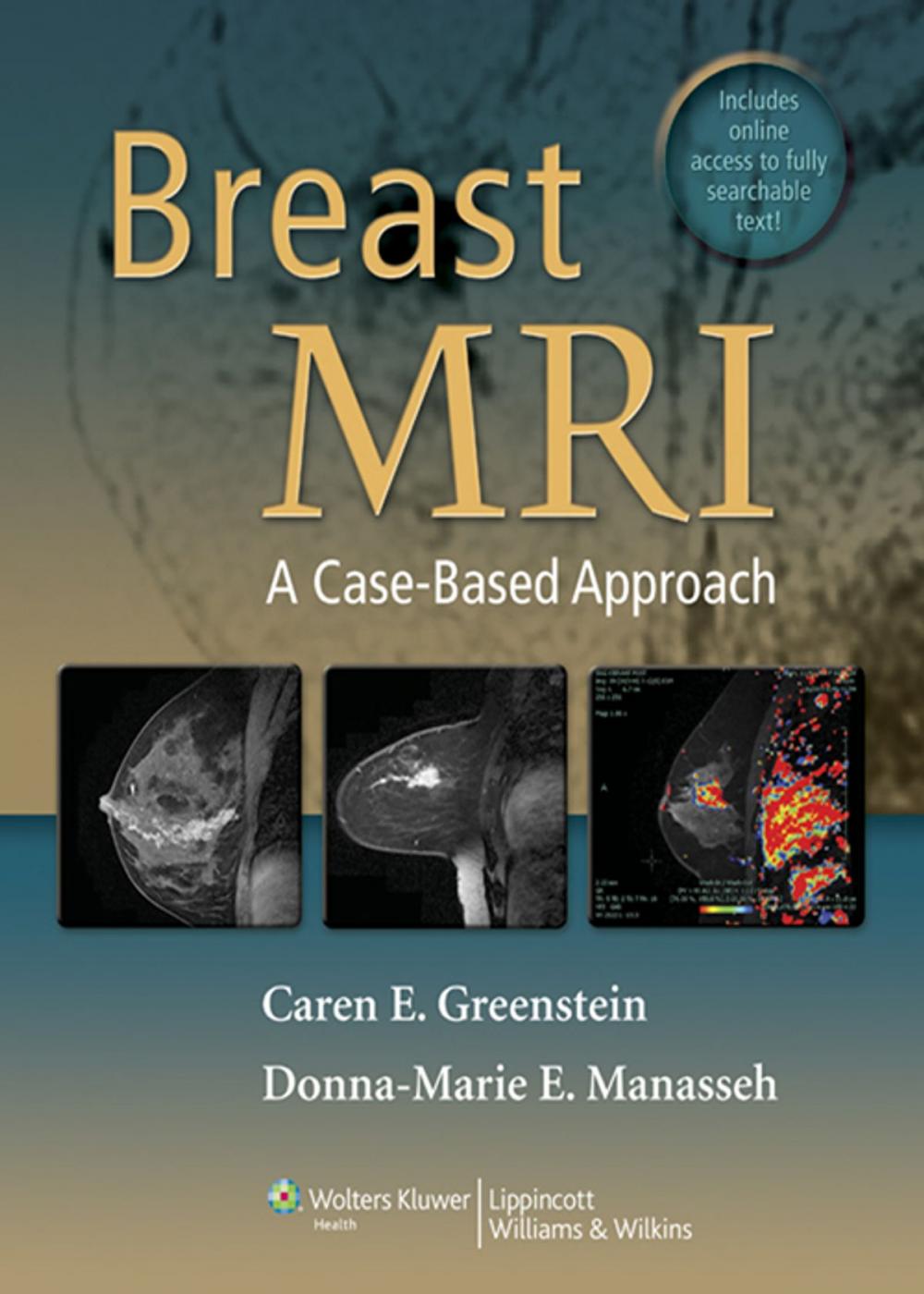 Big bigCover of Breast MRI