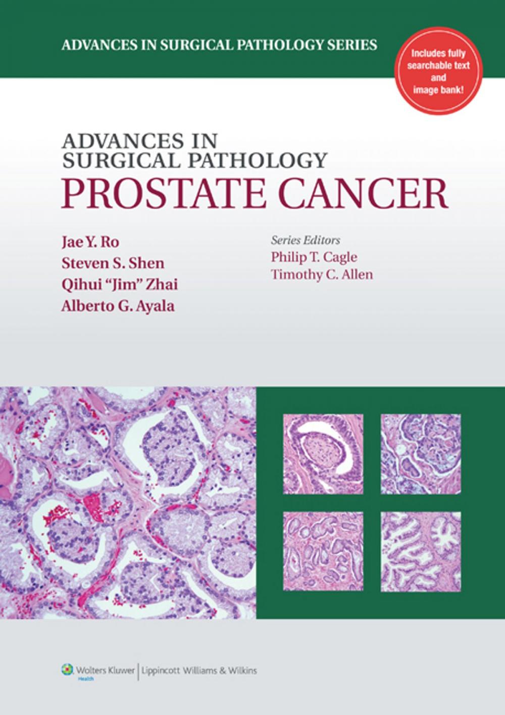 Big bigCover of H27Advances in Surgical Pathology: Prostate Cancer