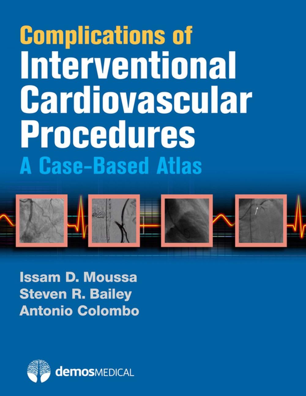 Big bigCover of Complications of Interventional Cardiovascular Procedures