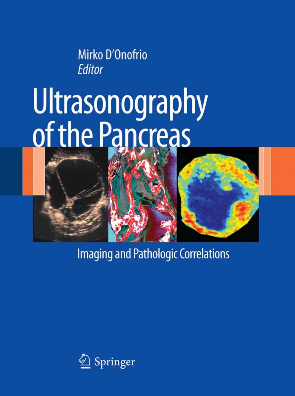 Big bigCover of Ultrasonography of the Pancreas