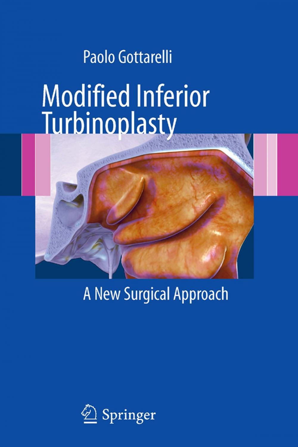 Big bigCover of Modified Inferior Turbinoplasty