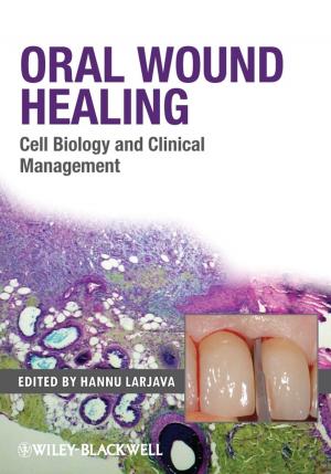 Cover of the book Oral Wound Healing by Drude Dahlerup