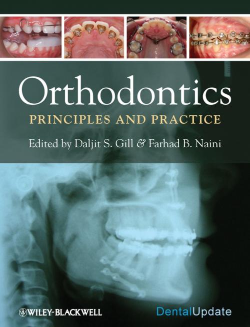 Cover of the book Orthodontics by Farhad B. Naini, Daljit S. Gill, Wiley