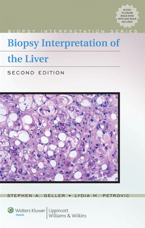 Cover of the book Biopsy Interpretation of the Liver by Stephen A. Geller, Lydia M. Petrovic, Wolters Kluwer Health