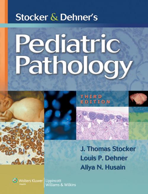 Cover of the book Stocker and Dehner's Pediatric Pathology by J. Thomas Stocker, Louis P. Dehner, Aliya N. Husain, Wolters Kluwer Health