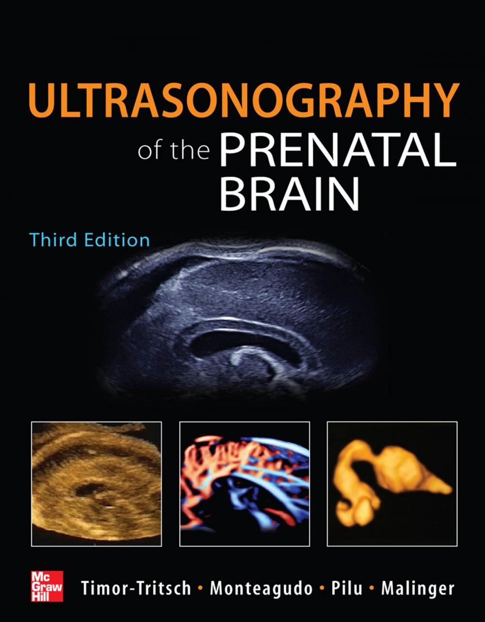 Big bigCover of Ultrasonography of the Prenatal Brain, Third Edition